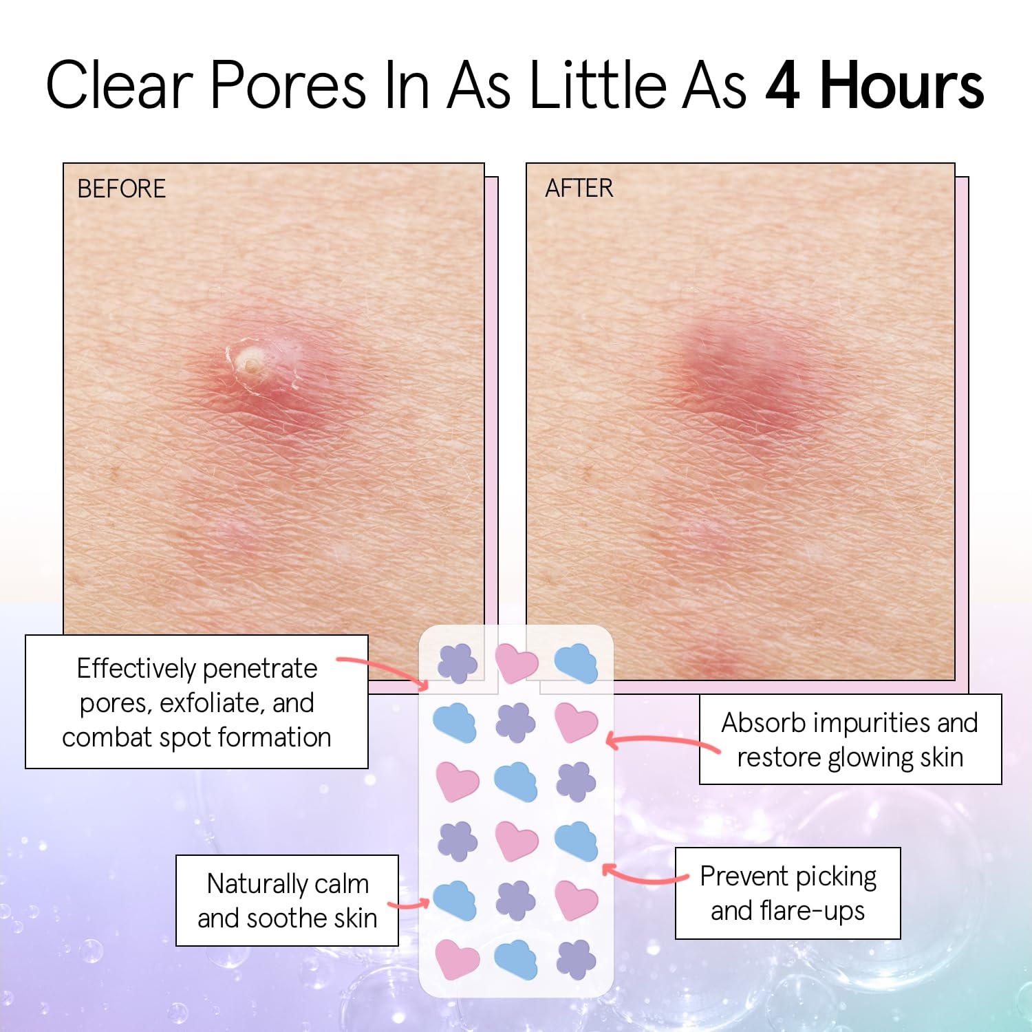 image:imagegrace amp stella Award Winning Pore Strip Pimple Patches for Face72 Count Pack of 1