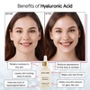 grace & stella Award Winning Hyaluronic Acid Serum (50ml/1.7 fl oz) Hydrating Hyaluronic Acid Serum for Face – Acido Hialuronico for Women – Remove Fine Lines, Wrinkles, Anti Aging – Vegan Skincare(0.34 Fl Oz (Pack of 1))