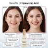 grace & stella Award Winning Hyaluronic Acid Serum (50ml/1.7 fl oz) Hydrating Hyaluronic Acid Serum for Face – Acido Hialuronico for Women – Remove Fine Lines, Wrinkles, Anti Aging – Vegan Skincare(1.7 Fl Oz (Pack of 2))