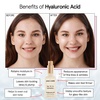 grace & stella Award Winning Hyaluronic Acid Serum (50ml/1.7 fl oz) Hydrating Hyaluronic Acid Serum for Face – Acido Hialuronico for Women – Remove Fine Lines, Wrinkles, Anti Aging – Vegan Skincare(1 Fl Oz (Pack of 1))