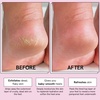 grace & stella Award-Winning Foot Peel Mask (4 Pairs, Lavender)(Lavender with Aloe Vera  4 Pairs)
