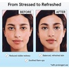 grace & stella Hypochlorous Acid Spray for Face – Body Acne Spray – Gentle Face MIst to Calm Redness & Flare-Ups Back Acne – Soothing Facial Mist for Sensitive Skin – Travel Size (60 ml/2 fl oz)(60 ml)