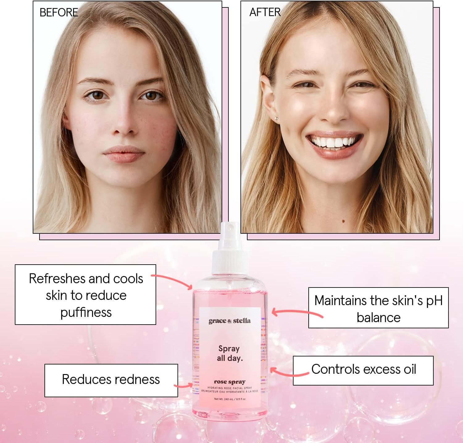 image:imagegrace amp stella Award Winning Rose Water Spray for Face with Glycerin amp Aloe Vera Travel Size 30ml Rosewater Face Mist for All Skin Types Hydrating Calming Rejuvenating Facial Toner Vegan30ml